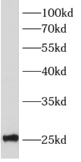      anti- ALKBH7 antibody