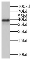      anti- C10orf27 antibody