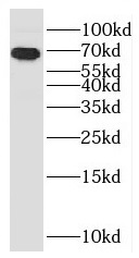 anti- C10orf68 antibody