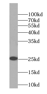      anti- C12orf69 antibody