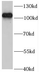      anti- C10orf28 antibody