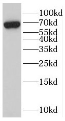 anti- C13orf18 antibody