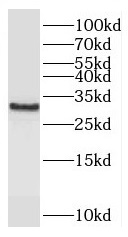      anti- C11orf49 antibody