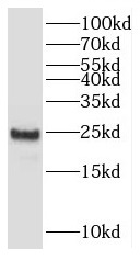      anti- C11orf74 antibody