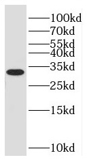      anti- C11orf57 antibody