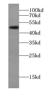      anti- C14orf138 antibody