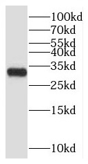      anti- C11orf70 antibody