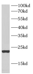      anti- C11orf51 antibody