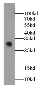      anti-C11orf79 antibody