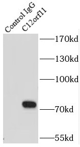      anti- C12orf11 antibody