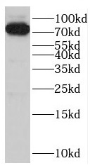      anti- C12orf11 antibody