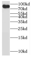      anti- BRSK2 antibody