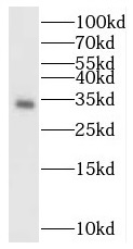      anti- BST2 antibody