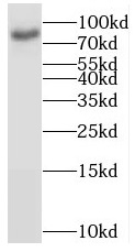      anti- BRSK1 antibody