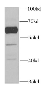      anti- BTD antibody