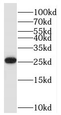 anti- BTG4 antibody