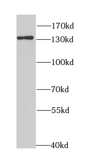      anti- BUB1 antibody