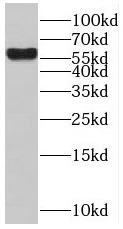      anti- BTBD16 antibody