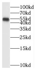      anti- BTBD1 antibody