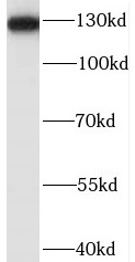      anti- BubR1 antibody