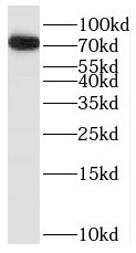      anti- BTK antibody