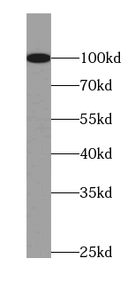 anti- BRIT1 antibody