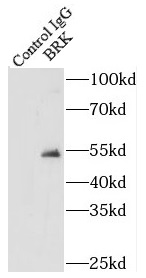      anti- BRK antibody