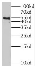      anti- BRK antibody