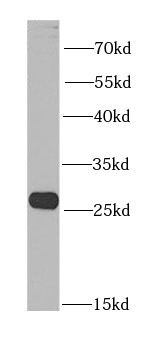      anti- BNIP1 antibody