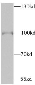      anti- BRAF antibody