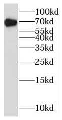      anti- BRD9 antibody