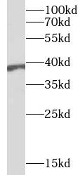 anti- BPNT1 antibody