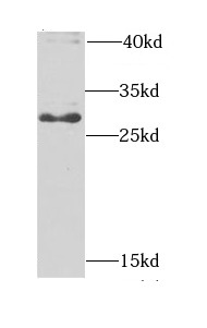 anti- BPGM antibody