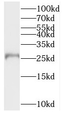      anti- BPHL antibody