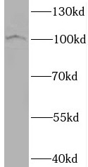 anti- BRD3 antibody