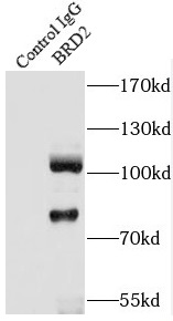 BRD2抗体