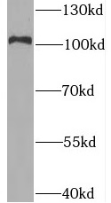      anti- BRD2 antibody