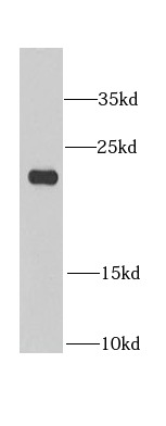      anti- BLVRB antibody