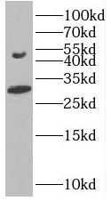      anti- BMP9 antibody