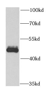 anti- BMP3 antibody