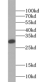 anti- BLVRA antibody