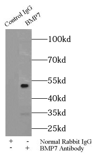 anti- BMP7 antibody