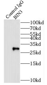 anti- BIN3 antibody