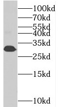  anti- BIN3 antibody