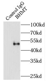 anti- BHMT antibody