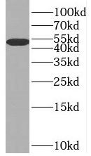 anti- BHMT antibody