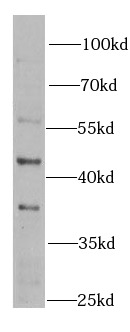  anti- BLMH antibody