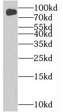  anti- BIN2 antibody