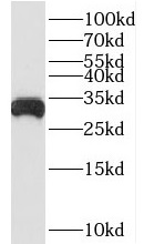      anti- BDH1 antibody