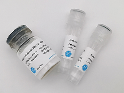 人源Tryptophanyl tRNA synthetase重组蛋白